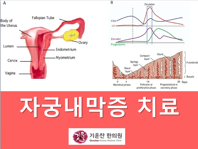 증상,원인과 임신한약에 대해 기운찬한의원에서 알려드립니다. (노원구/동대문구/중랑구/광진구) : 네이버 블로그 증상,원인과 임신한약에 대해 기운찬한의원에서 알려드립니다. (노원구/동대문구/중랑구/광진구) : 네이버 블로그